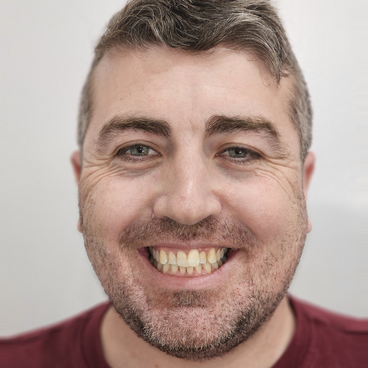 Before treatment